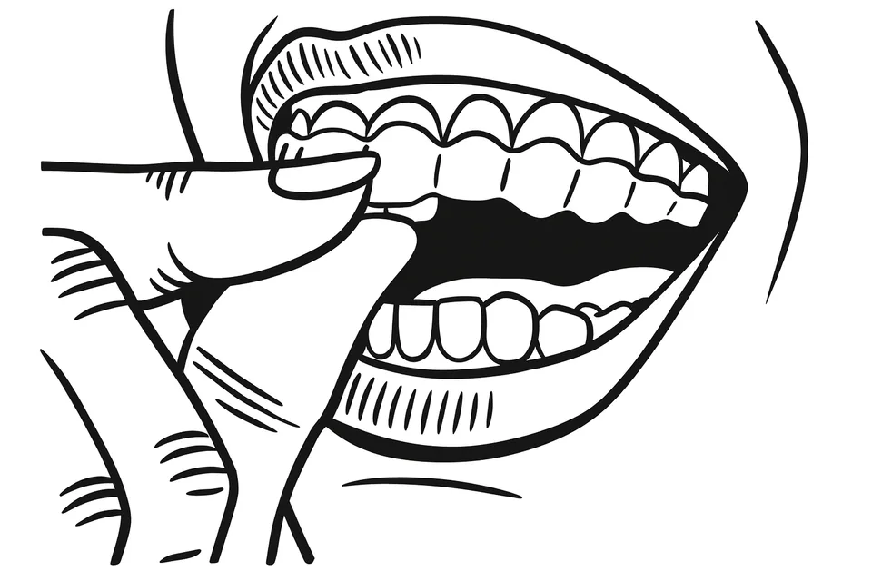 Removing a dental aligner comfortably